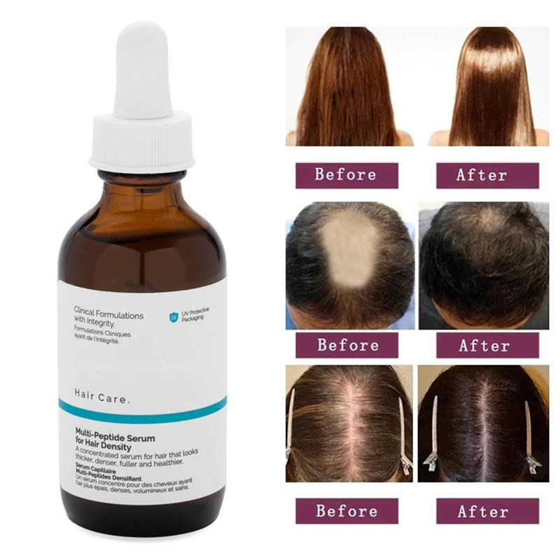 The ordinary hair care multi-peptide serum for hair density (2)